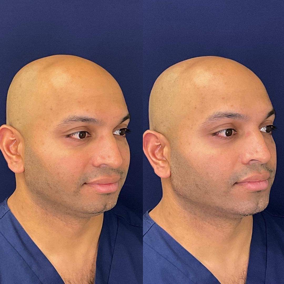 Akash Chandawarkar, MD